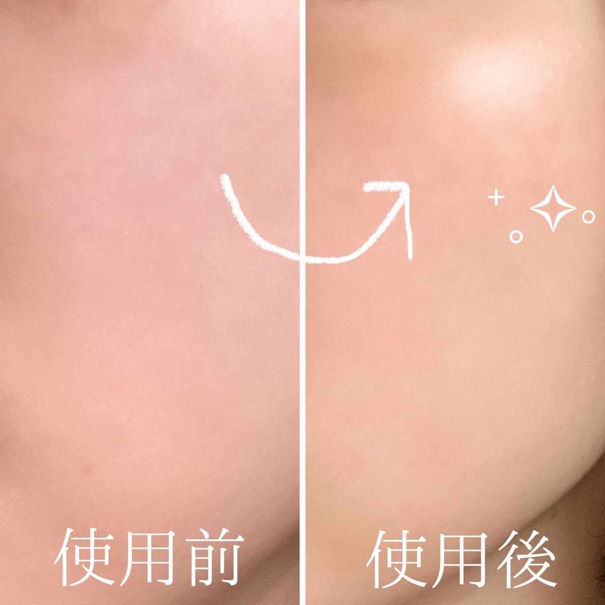 ザビタミンC23/IOPE/美容液を使ったクチコミ（3枚目）