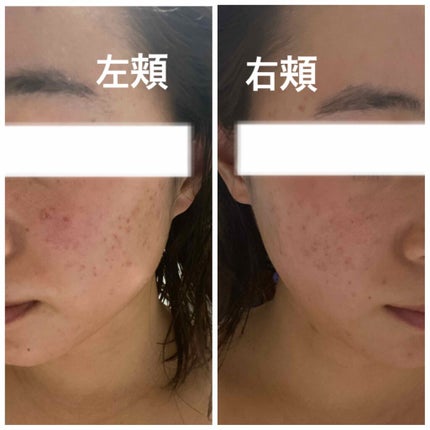 ウォッシャブル コールド クリーム/ちふれ/クレンジングクリームを使ったクチコミ(2枚目)