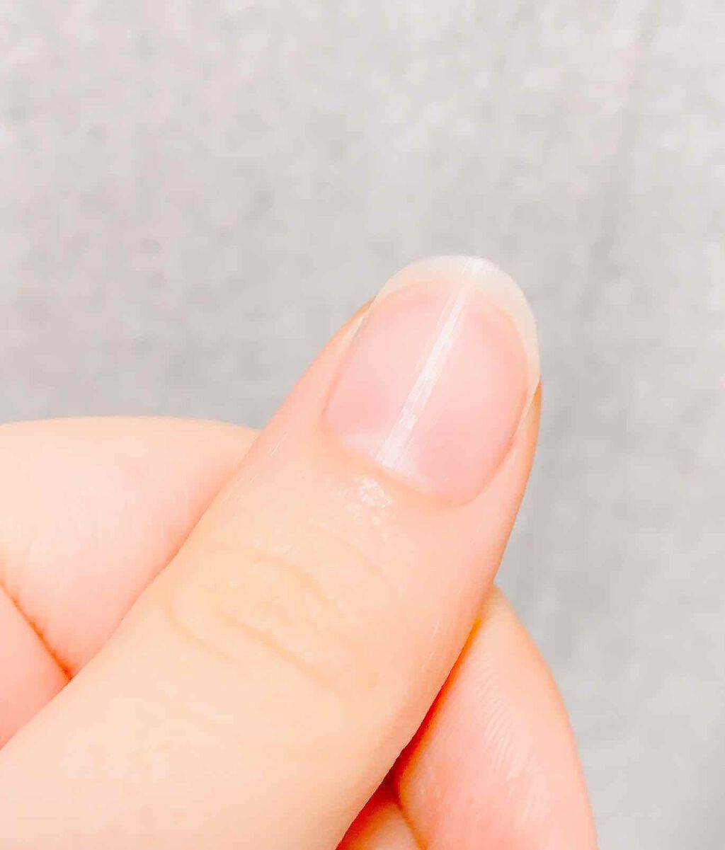 キューティクルオイル/ネイルホリック/ネイルオイル・トリートメントを使ったクチコミ(2枚目)