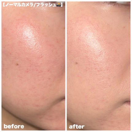 カバーリシャスセラムファンデーション/BANILA CO/リキッドファンデーションを使ったクチコミ(4枚目)