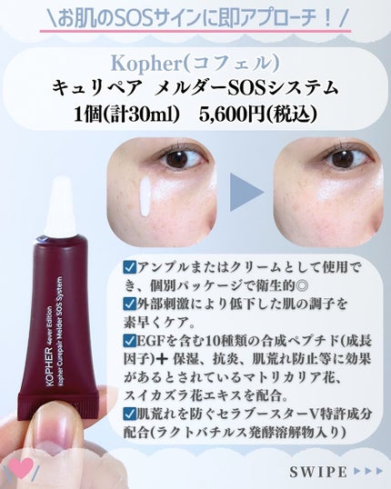SOSメルダーシステム/KOPHER/フェイスクリームを使ったクチコミ(2枚目)