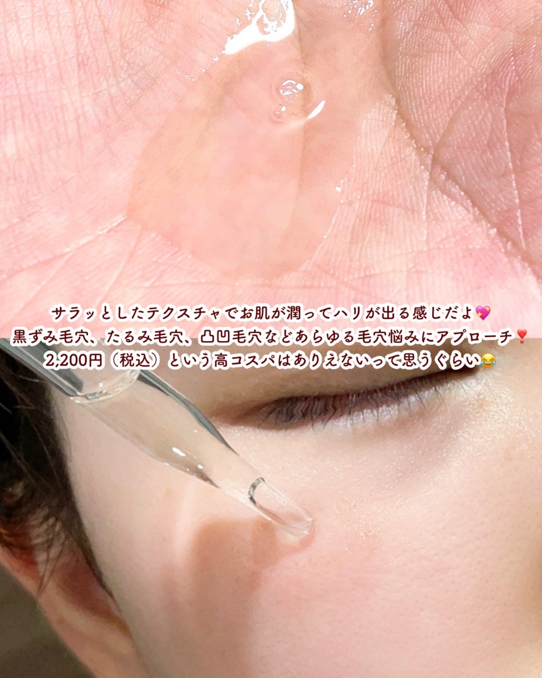 ダーマレーザースーパーVC100マスク/クオリティファースト/シートマスク・パックを使ったクチコミ(4枚目)