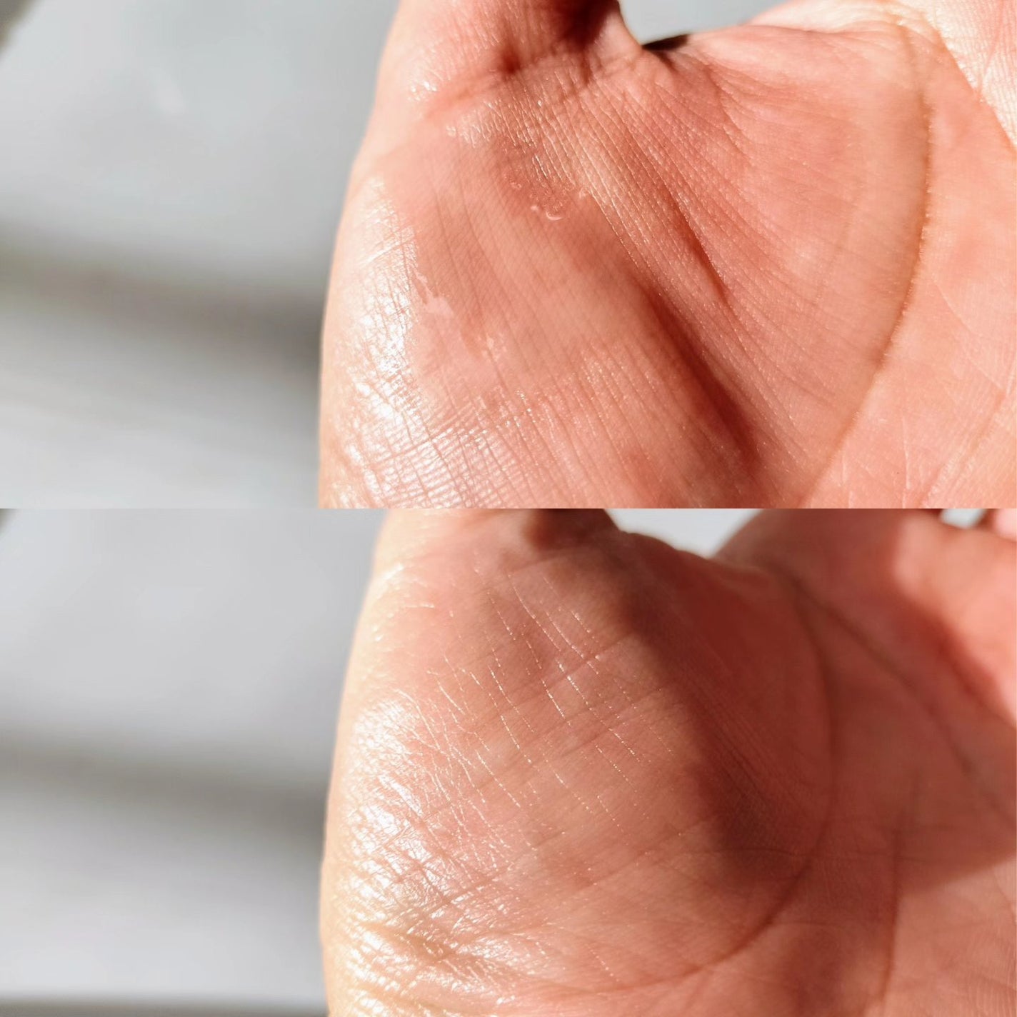 マジックティーツリーオイル/ブラン/フェイスオイルを使ったクチコミ(3枚目)