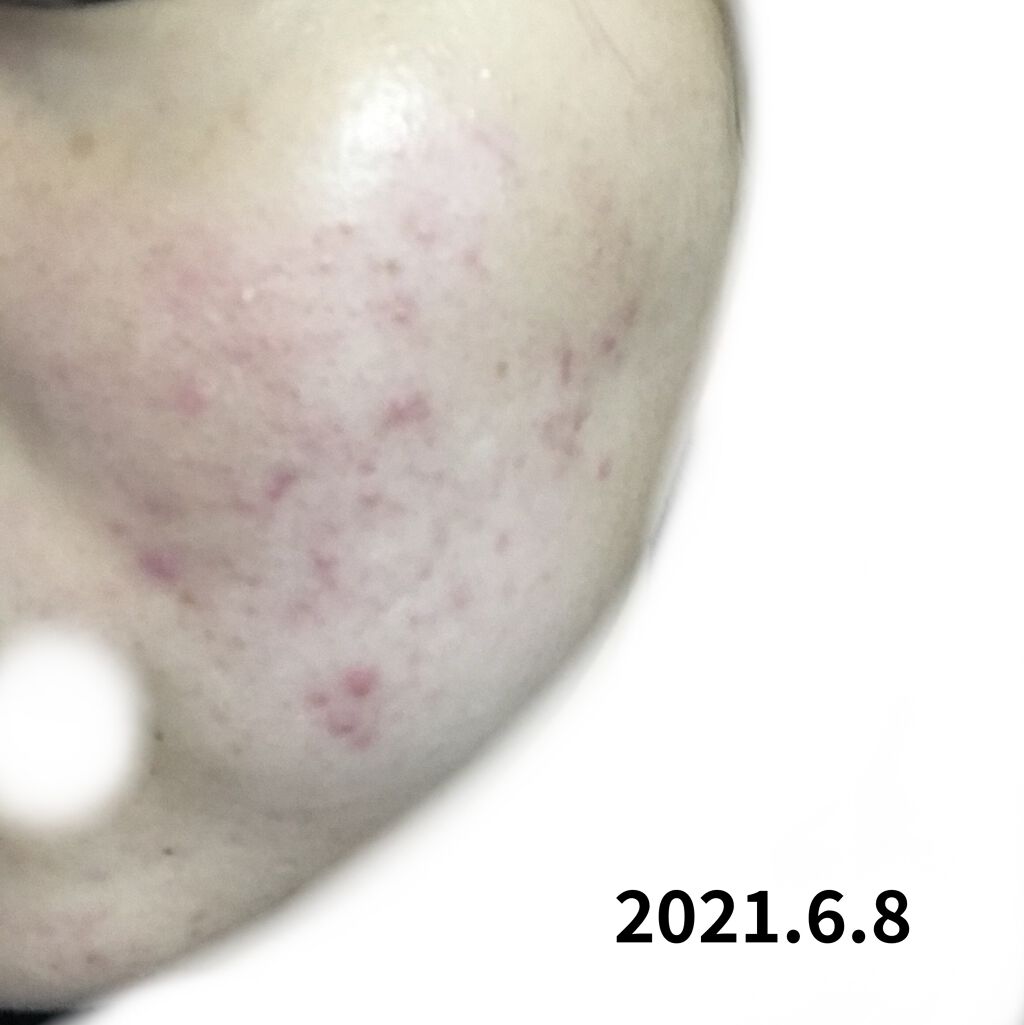 デュオ ザ クレンジングバーム クリア/DUO/クレンジングバームを使ったクチコミ（3枚目）