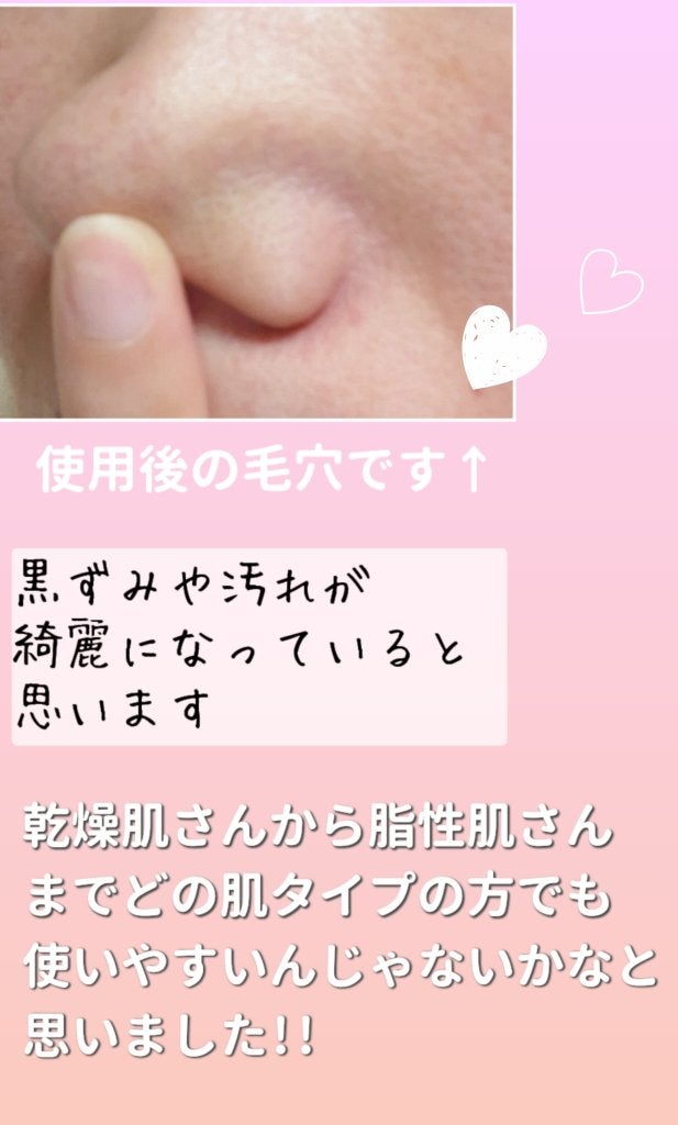 &honey ã¯ã¬ã³ãžã³ã°ããŒã ã¡ã«ã㣠ããã/&honey/ã¯ã¬ã³ãžã³ã°ããŒã ã䜿ã£ãã¯ãã³ãïŒ5æç®ïŒ