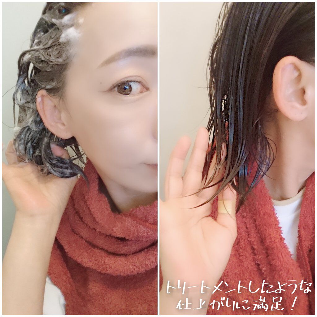 薬用スカルプエッセンス/HAIRICHE/頭皮ローションを使ったクチコミ（3枚目）