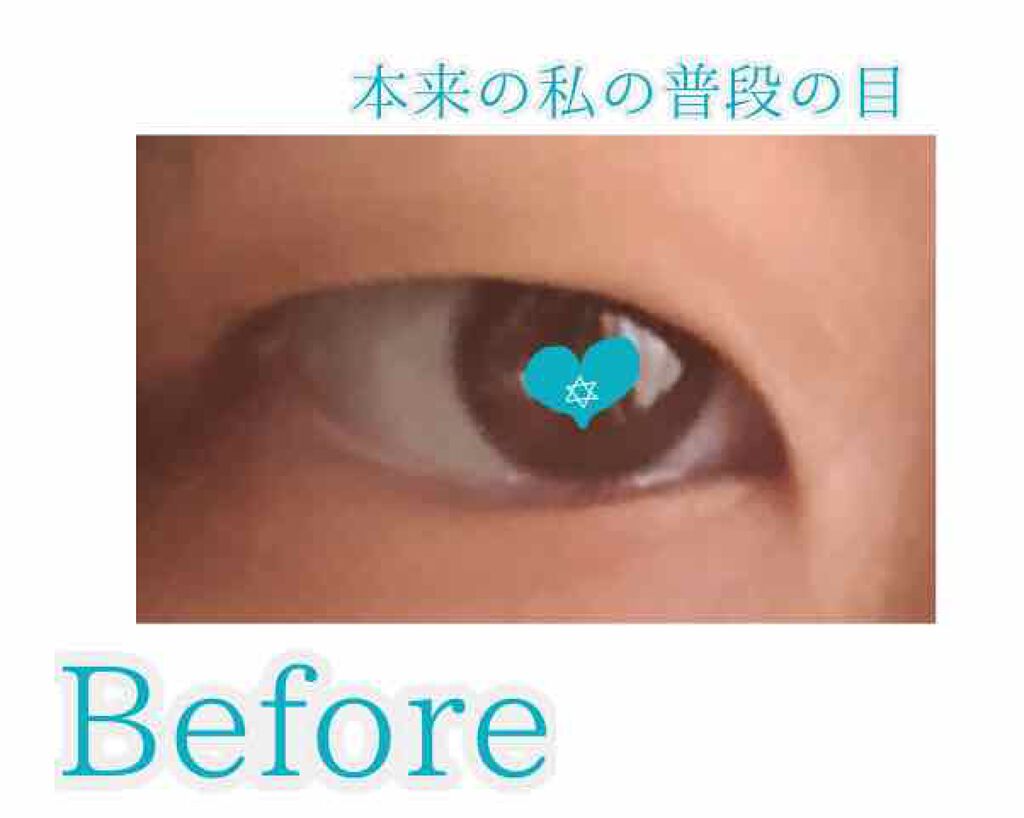 ひとえ・奥ぶたえ用カーラー/アイプチ®/ビューラーを使ったクチコミ（2枚目）