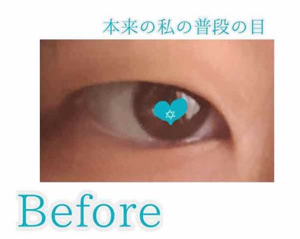 ひとえ・奥ぶたえ用カーラー/アイプチ®/ビューラーを使ったクチコミ(2枚目)