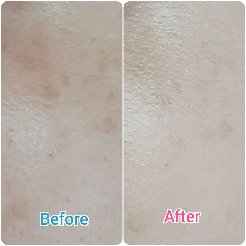 リキッド ファンデーション 20：オークル/iniks/リキッドファンデーションを使ったクチコミ（2枚目）