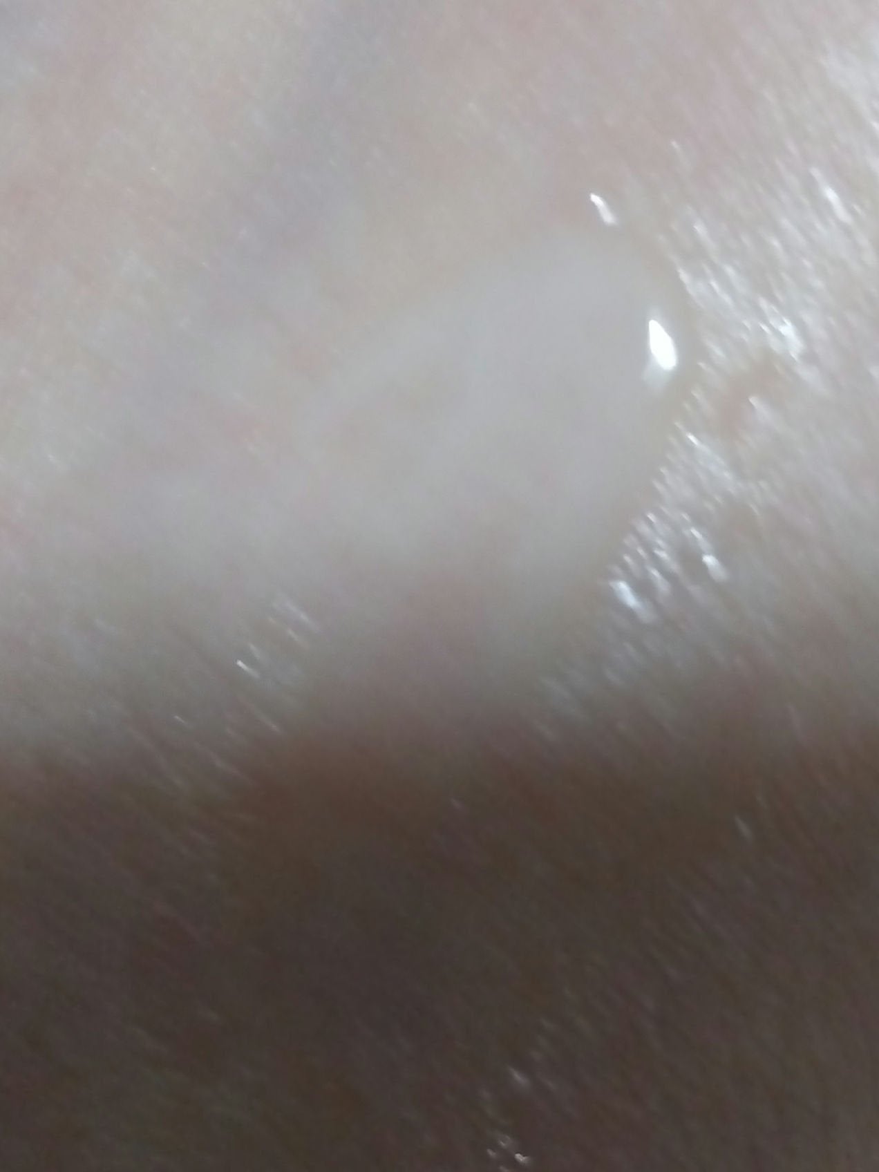 ビタミンレチノールリペアアンプル/BIOHEAL BOH/美容液を使ったクチコミ(3枚目)