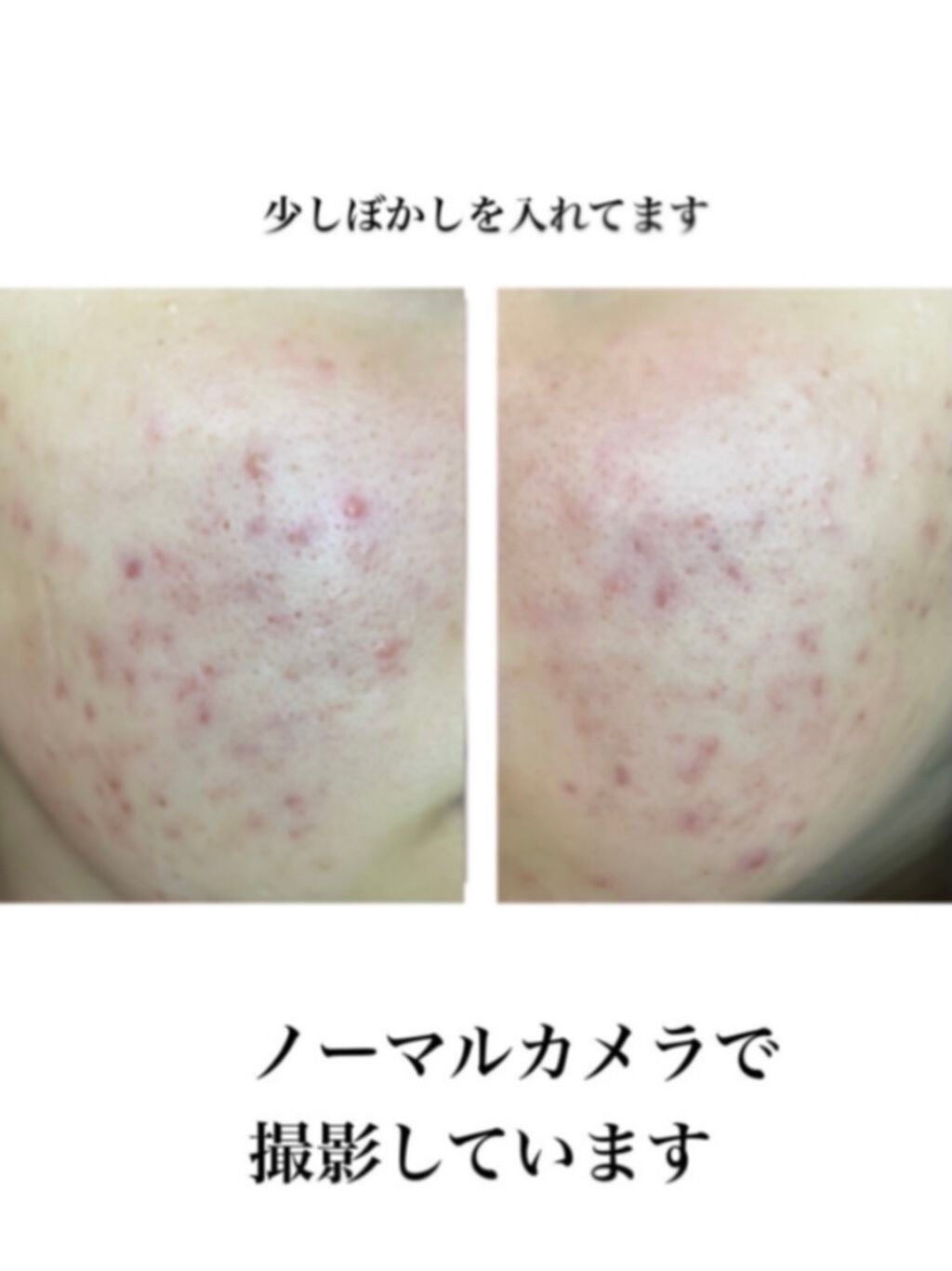 薬用 しみ 集中対策 美容液/メラノCC/美容液を使ったクチコミ(2枚目)