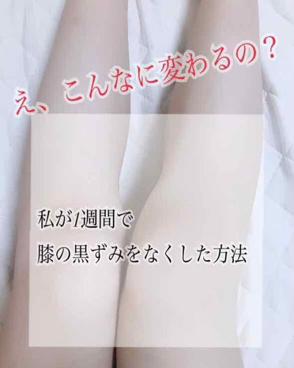 ニベアクリーム/ニベア/ボディクリームを使ったクチコミ(1枚目)