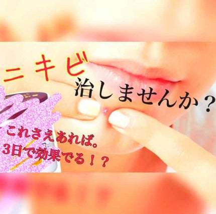 オロナインH軟膏 (医薬品)/オロナイン/その他を使ったクチコミ(1枚目)