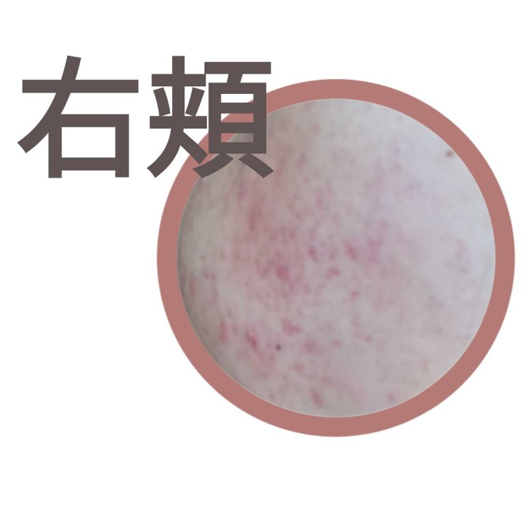 DHC マルチビタミン/DHC/美容サプリメントを使ったクチコミ（2枚目）