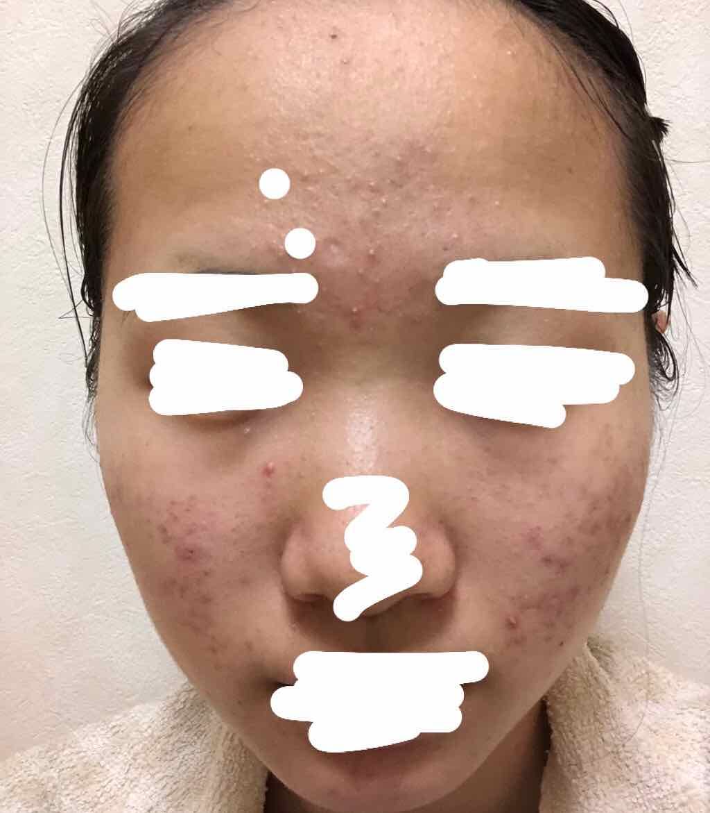 ドクタージャルト シカペアトナー/Dr.Jart＋/化粧水を使ったクチコミ（2枚目）