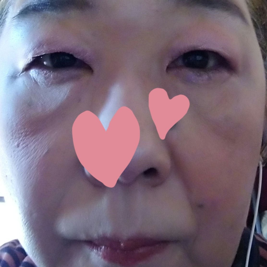 M クッション ファンデーション(プロカバー)/MISSHA/クッションファンデーションを使ったクチコミ(3枚目)