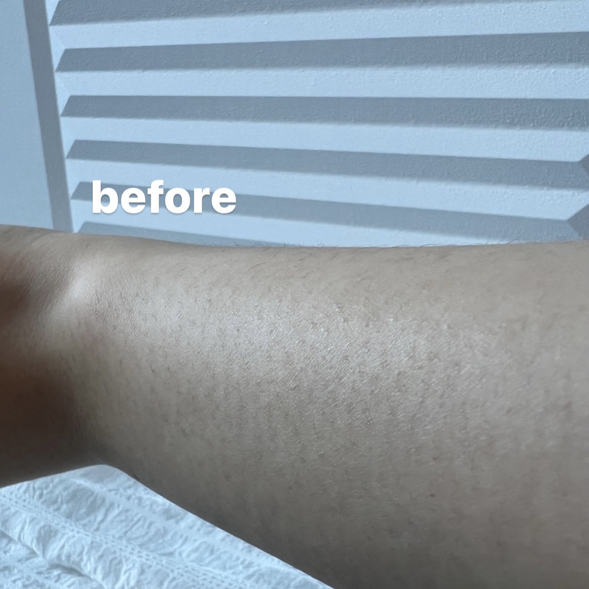 SIPL-1000C 家庭用光美容器/eosika/家庭用脱毛器を使ったクチコミ（3枚目）