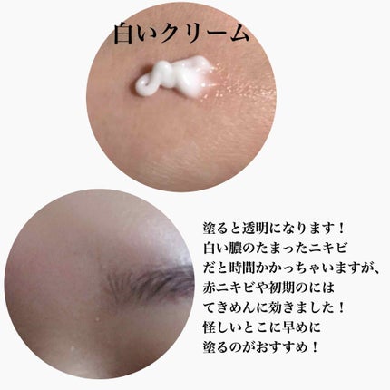 メディカルクリームc(医薬品)/メンソレータム アクネス25/その他を使ったクチコミ(3枚目)
