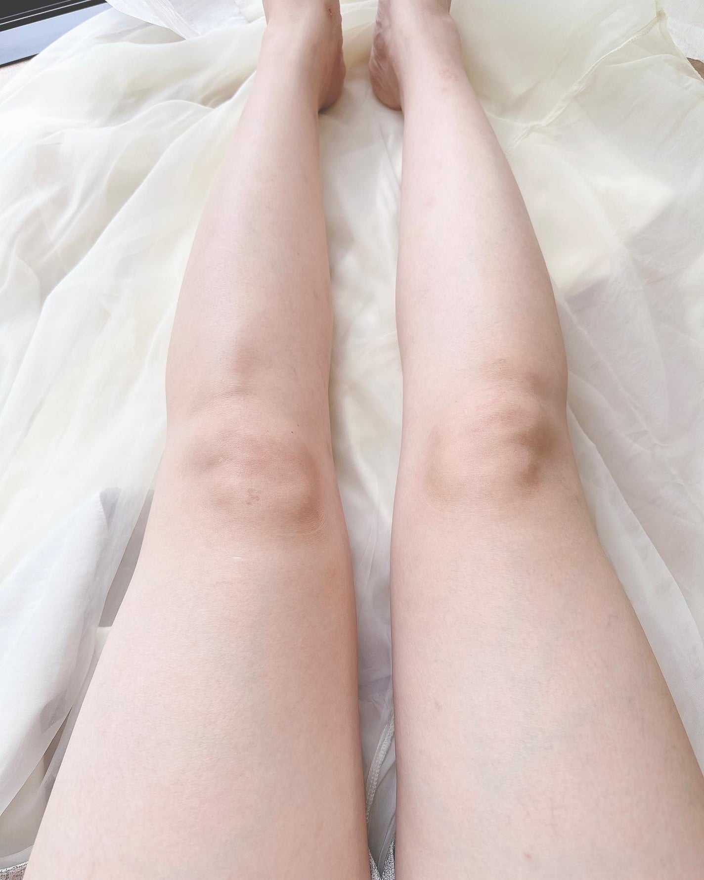 ベラミスW/ソシア/ボディサプリメントを使ったクチコミ(6枚目)