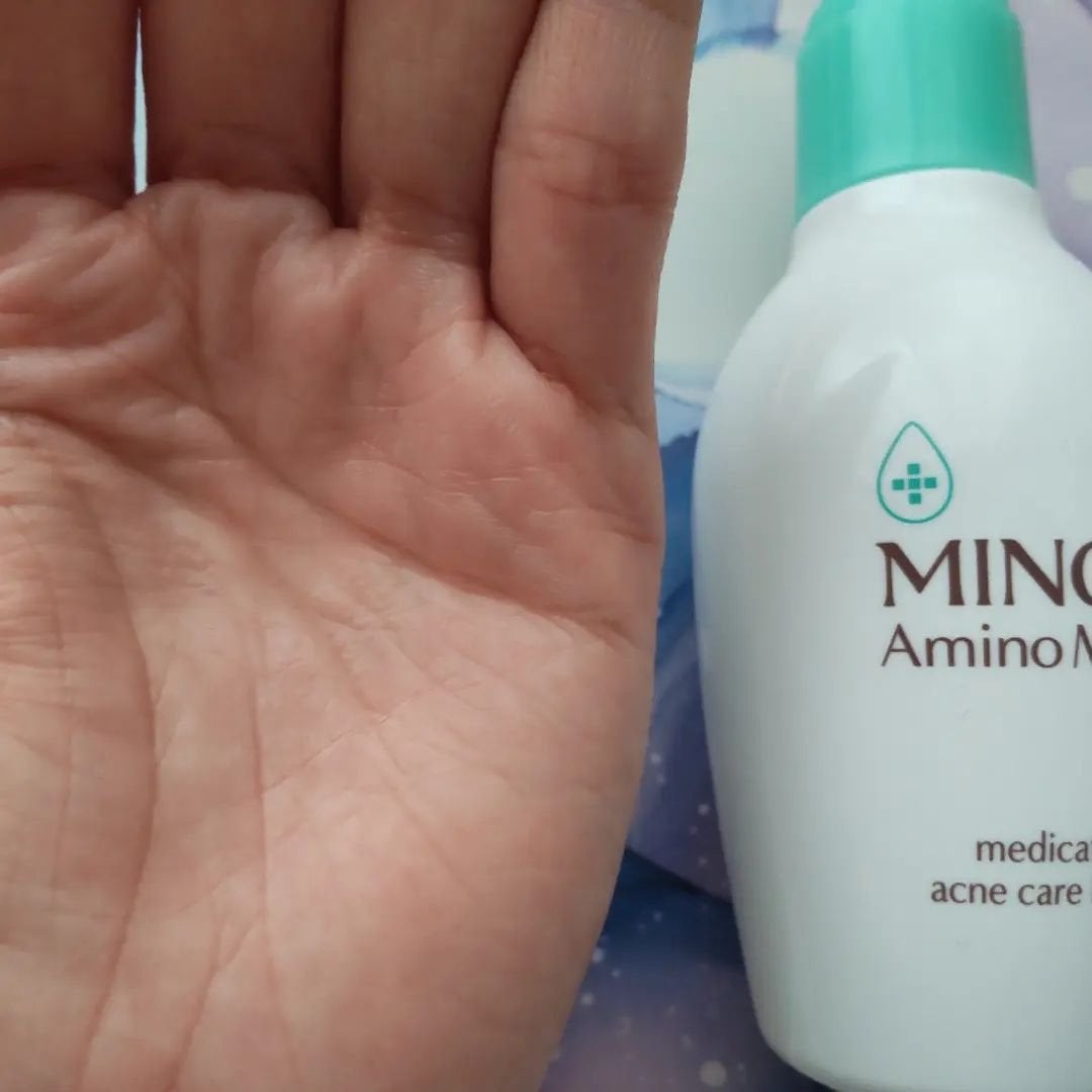 ミノン アミノモイスト 薬用アクネケア ローション/ミノン/化粧水を使ったクチコミ(3枚目)