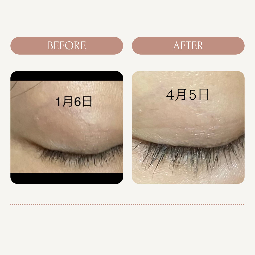 ラッシュアディクト アイラッシュコンディショニングセラム/soaddicted/まつげ美容液を使ったクチコミ（2枚目）