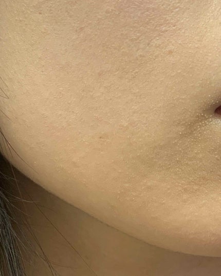 も on LIPS 「もうどうすればいいか全く分かりません‼️😭何をしても画像のよう..」(1枚目)