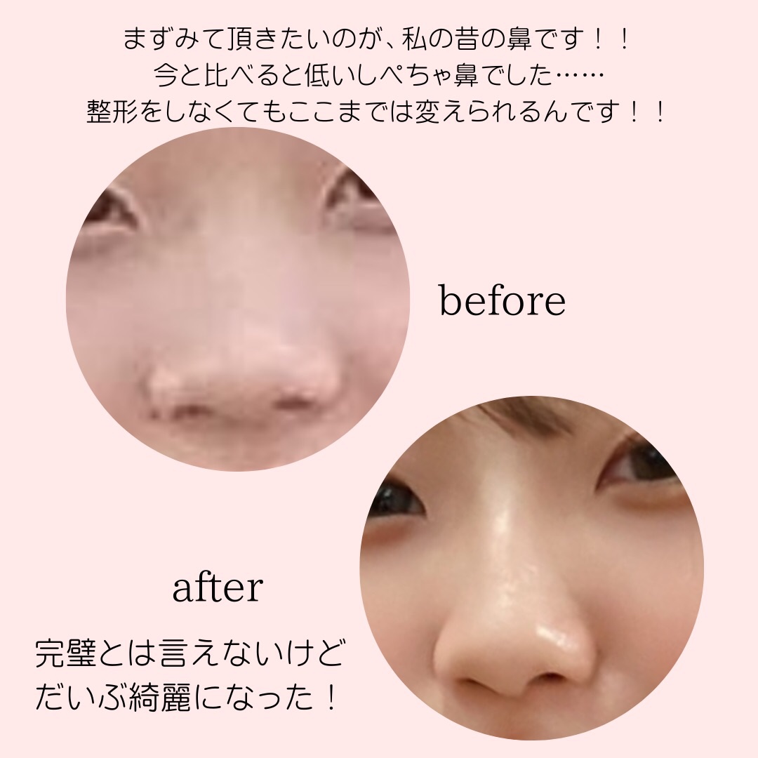 気になる人は気になる鼻の形に関する投稿
もしノーズシャドウなど質問あれば投稿作ります〜！

元投稿の方の♡が50↑になったらノーズシャドウやマッサージの投稿を作っていきたいと思いますっ！

#冬顔メイクテクニック #ノーズシャドウ #小鼻 