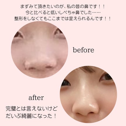 ののまる@投稿ある方フォロバ100 on LIPS 「気になる人は気になる鼻の形に関する投稿もしノーズシャドウなど質..」(1枚目)