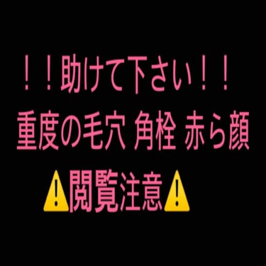 アクアレーベル スペシャルジェルクリームA （ホワイト）（医薬部外品）のクチコミ「小学生の頃、ニキビ肌で同い年の子の中でもかなり酷い肌でした。角栓もたまり、毛穴パックやピーリン.....」（1枚目）