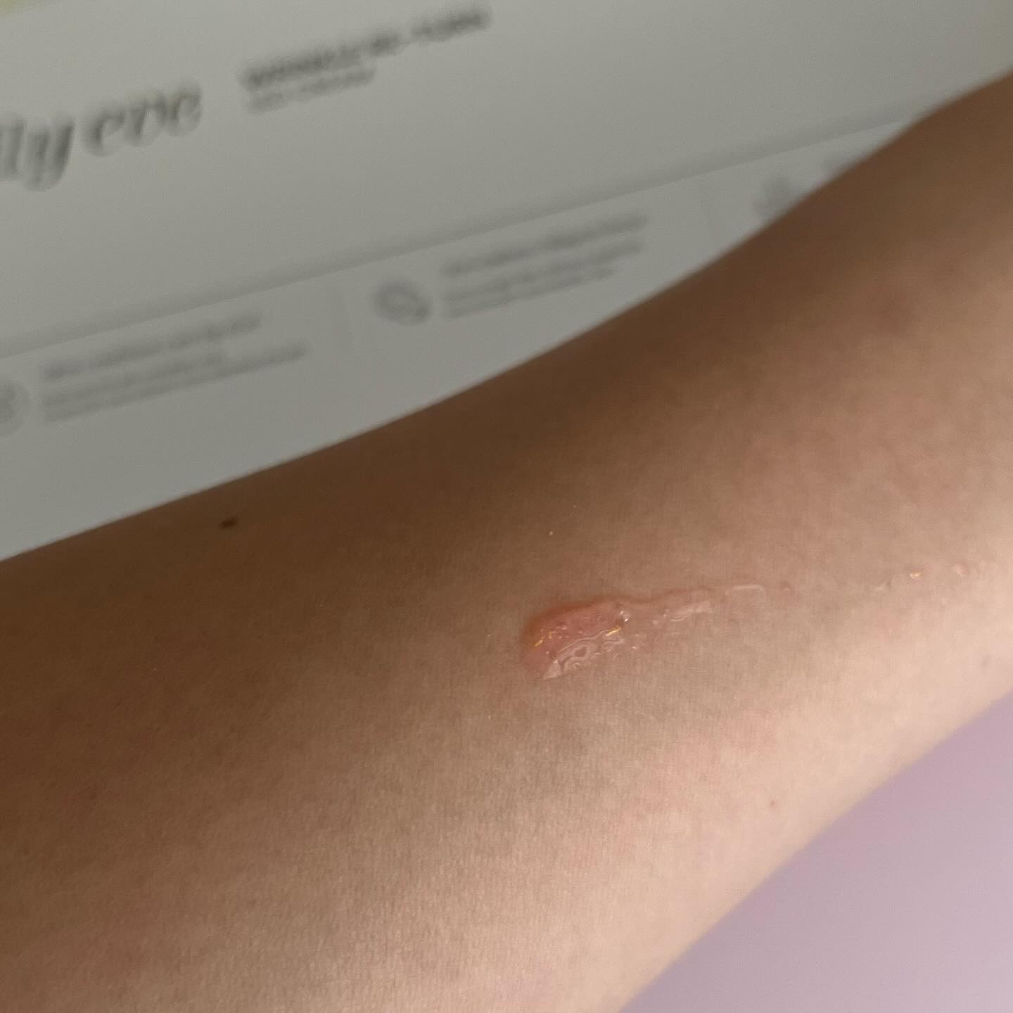 リンクルリターン 15ml/リリーイブ/美容液を使ったクチコミ（3枚目）