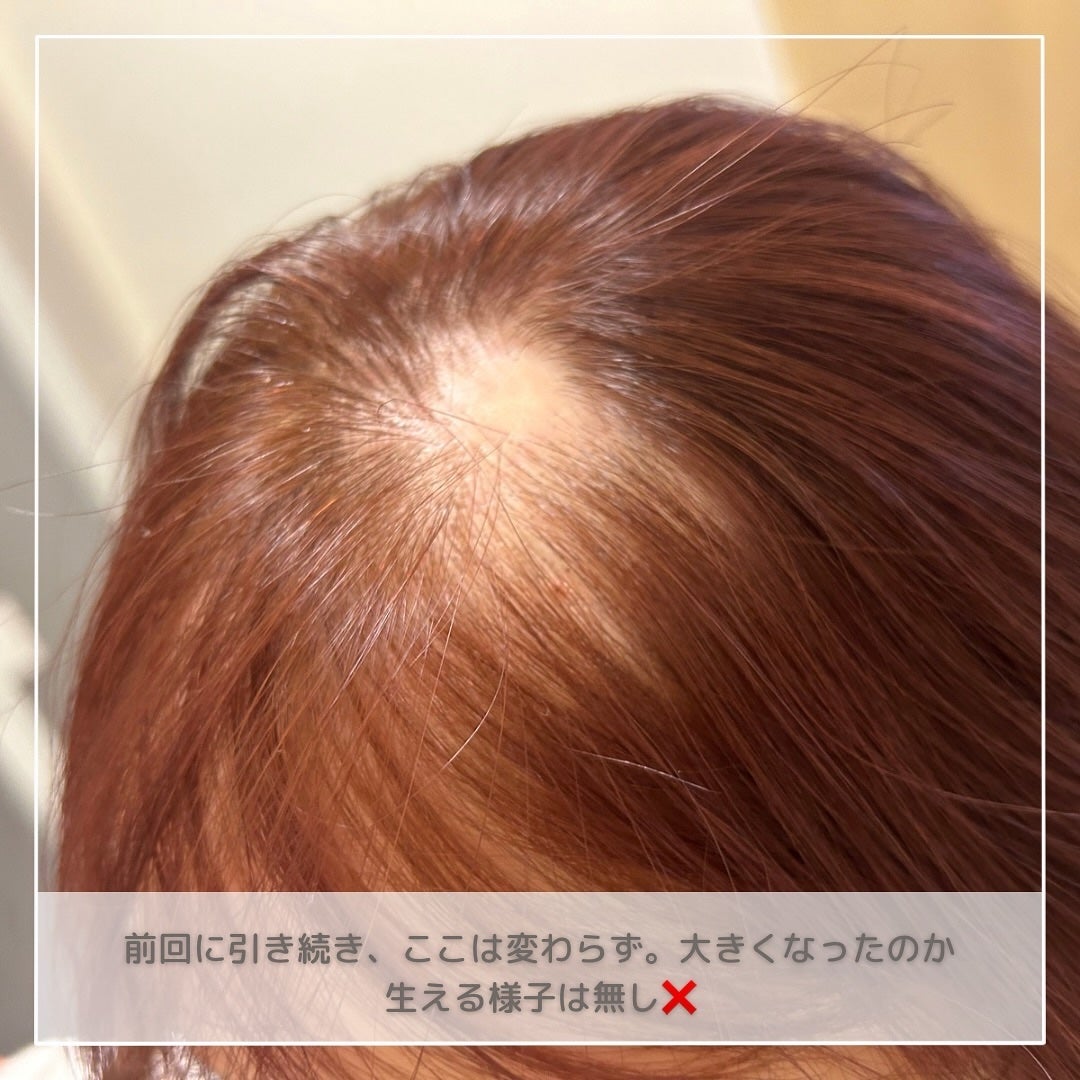 コンパクトスタイラー/TANGLE TEEZER/ヘアブラシを使ったクチコミ(2枚目)