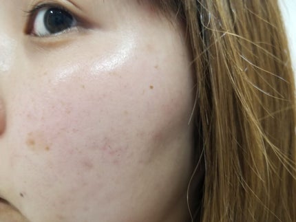 アクティブフェイスローション/gg/化粧水を使ったクチコミ(4枚目)