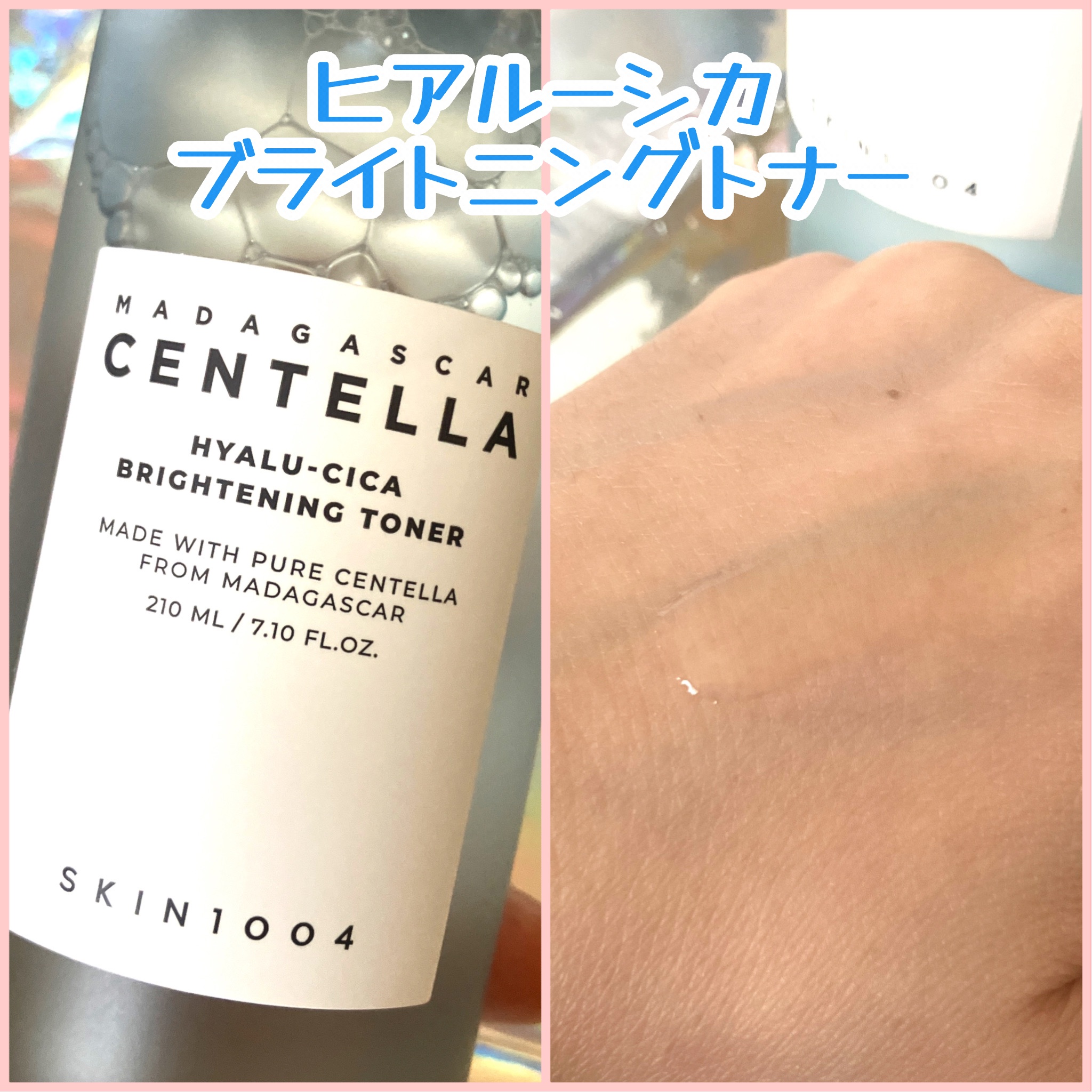 【SUMMER EDITION】ヒアルーシカ エディション/SKIN1004/スキンケアキットを使ったクチコミ（3枚目）