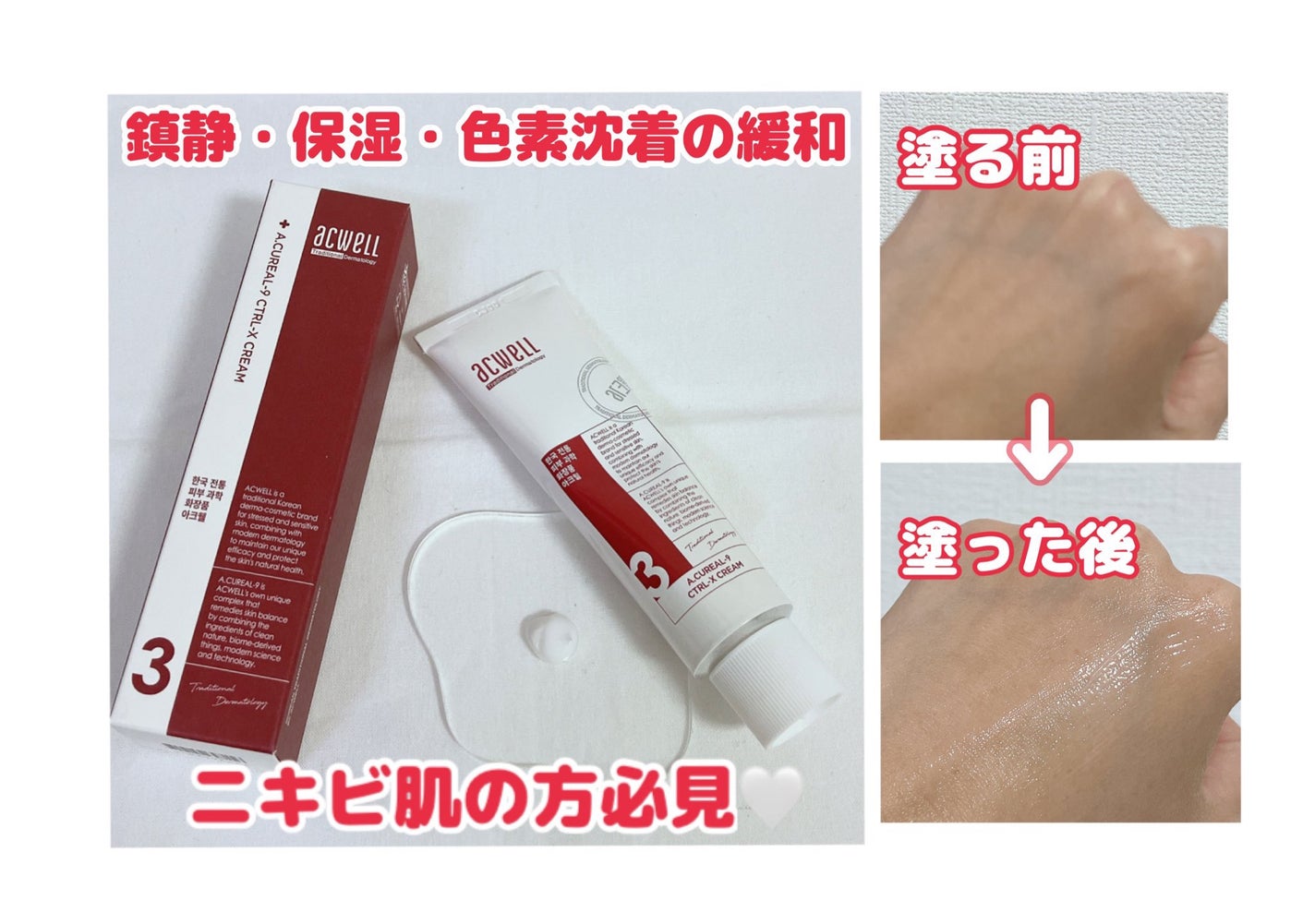 アキュリアルナインコントロールエックスクリーム/ACWELL/フェイスクリームを使ったクチコミ(1枚目)