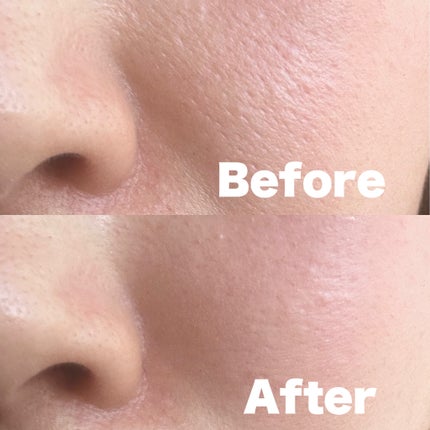 3番 集中ケアレチノール美容液/numbuzin/美容液を使ったクチコミ(4枚目)