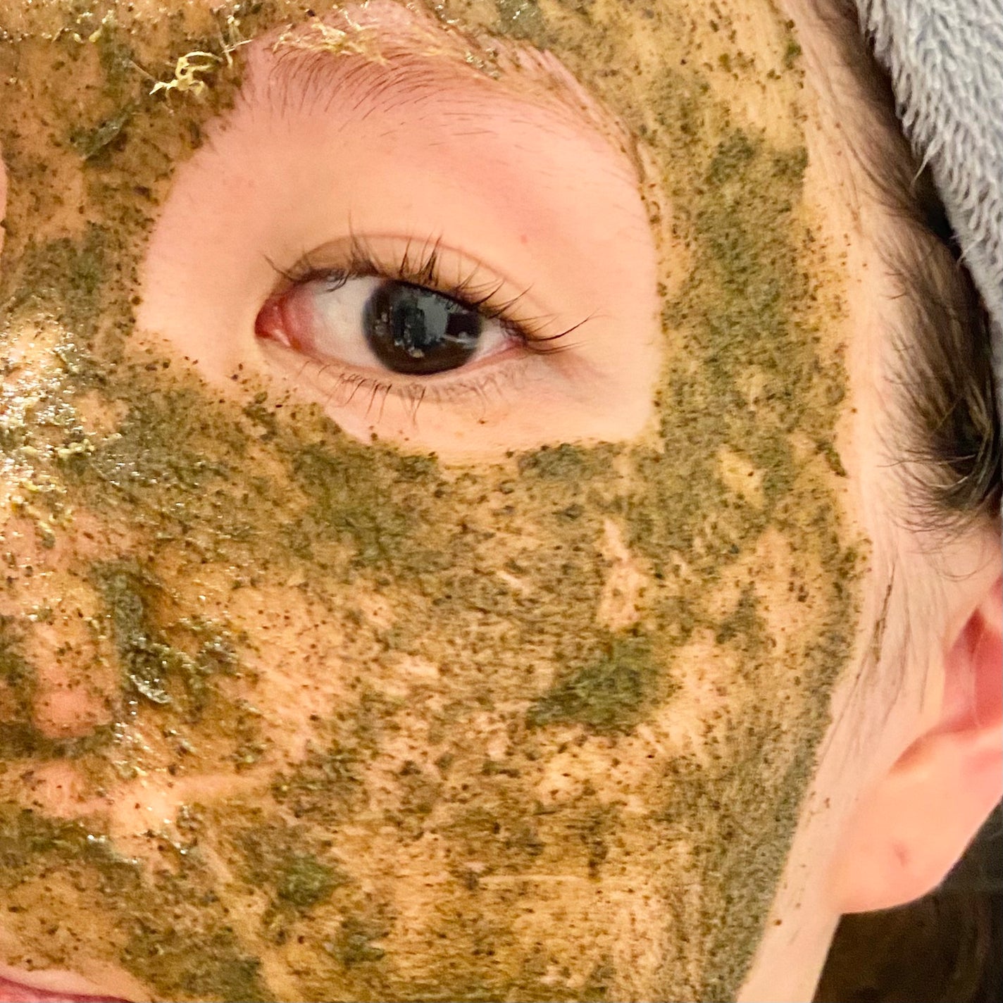 ãã£ãŒããªãŒããŒãããŒãªã³ã°ããã¯/WellDerma/æŽãæµãããã¯ã»ãã¹ã¯ã䜿ã£ãã¯ãã³ãïŒ3æç®ïŒ