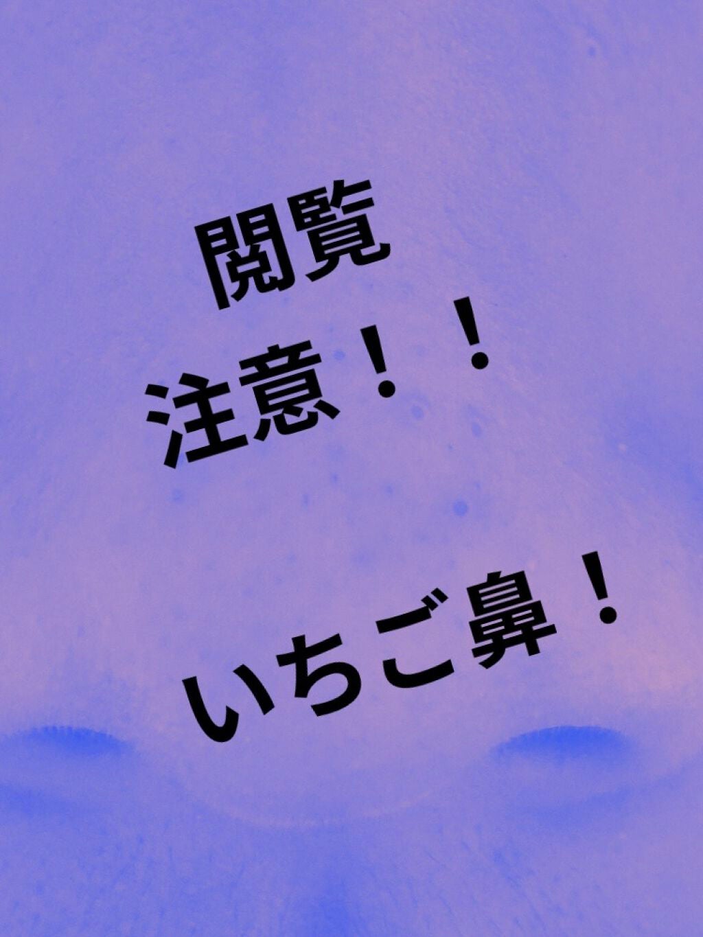 はる on LIPS 「いちご鼻が治らないーーーーー!!!前回の投稿も見てください!!..」(1枚目)