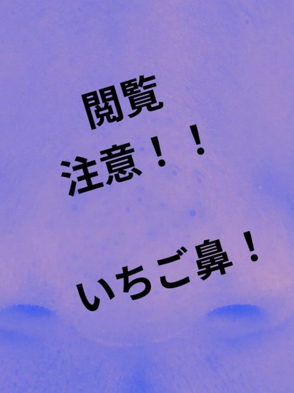 はる on LIPS 「いちご鼻が治らないーーーーー!!!前回の投稿も見てください!!..」(1枚目)