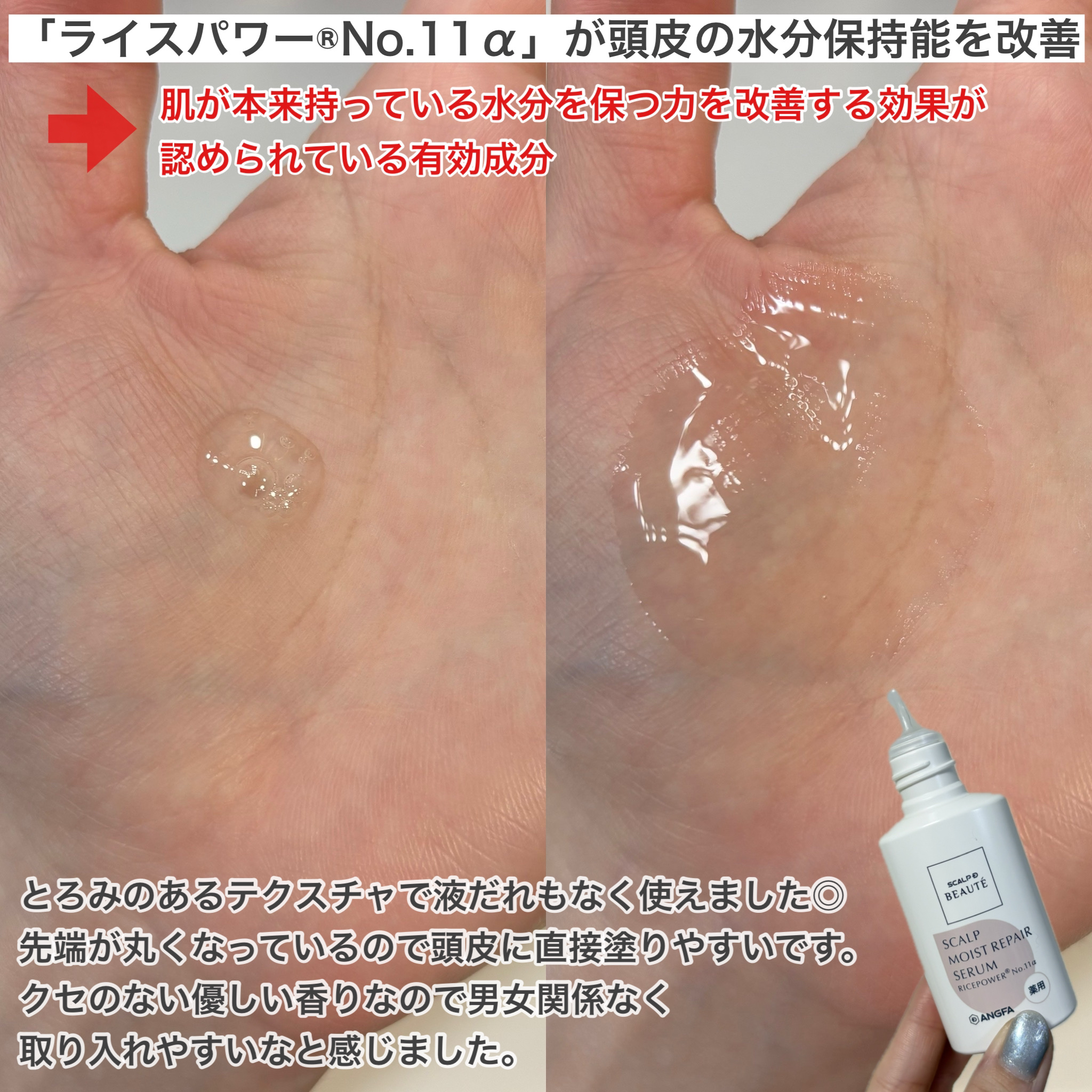 スカルプD ボーテ 薬用頭皮保湿美容液/アンファー(スカルプD)/頭皮ローションを使ったクチコミ（2枚目）