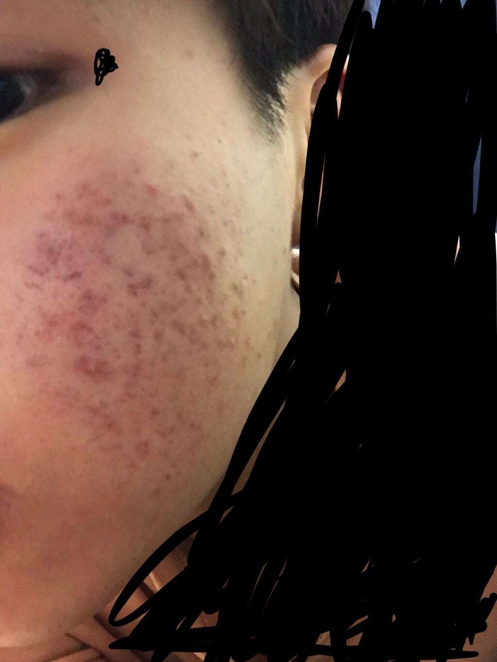 ロゼット洗顔パスタ アクネクリア/ロゼット/洗顔フォームを使ったクチコミ(1枚目)