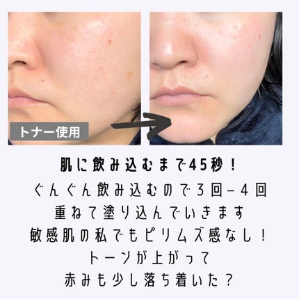 ドクダミ 77 スージングトナー/Anua/化粧水を使ったクチコミ(2枚目)