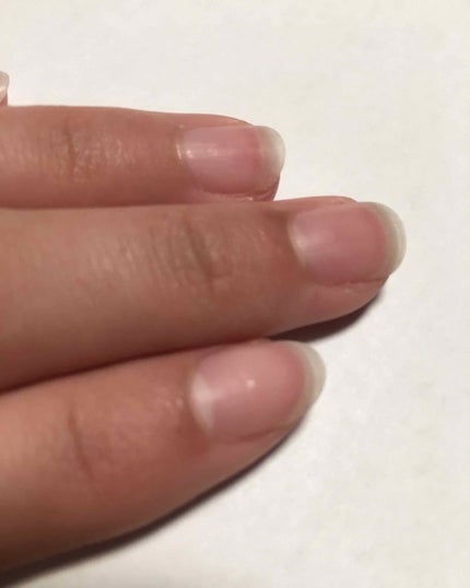 爪ミガキセット/デュカート/ネイル用品を使ったクチコミ(2枚目)