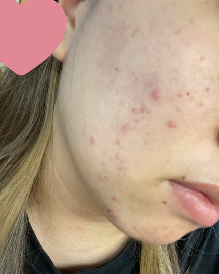 明色美顔水 薬用化粧水/美顔/化粧水を使ったクチコミ(2枚目)