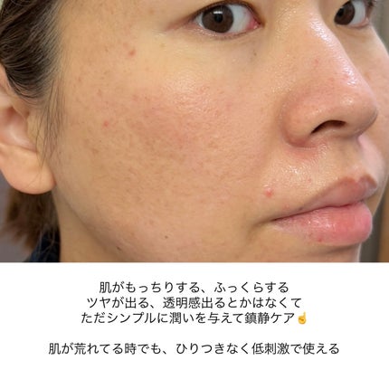 シカテロルトナー/beplain/化粧水を使ったクチコミ(6枚目)