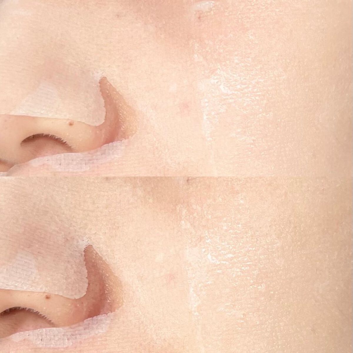 スキントラブルケア マスク/アルージェ/シートマスク・パックを使ったクチコミ(5枚目)