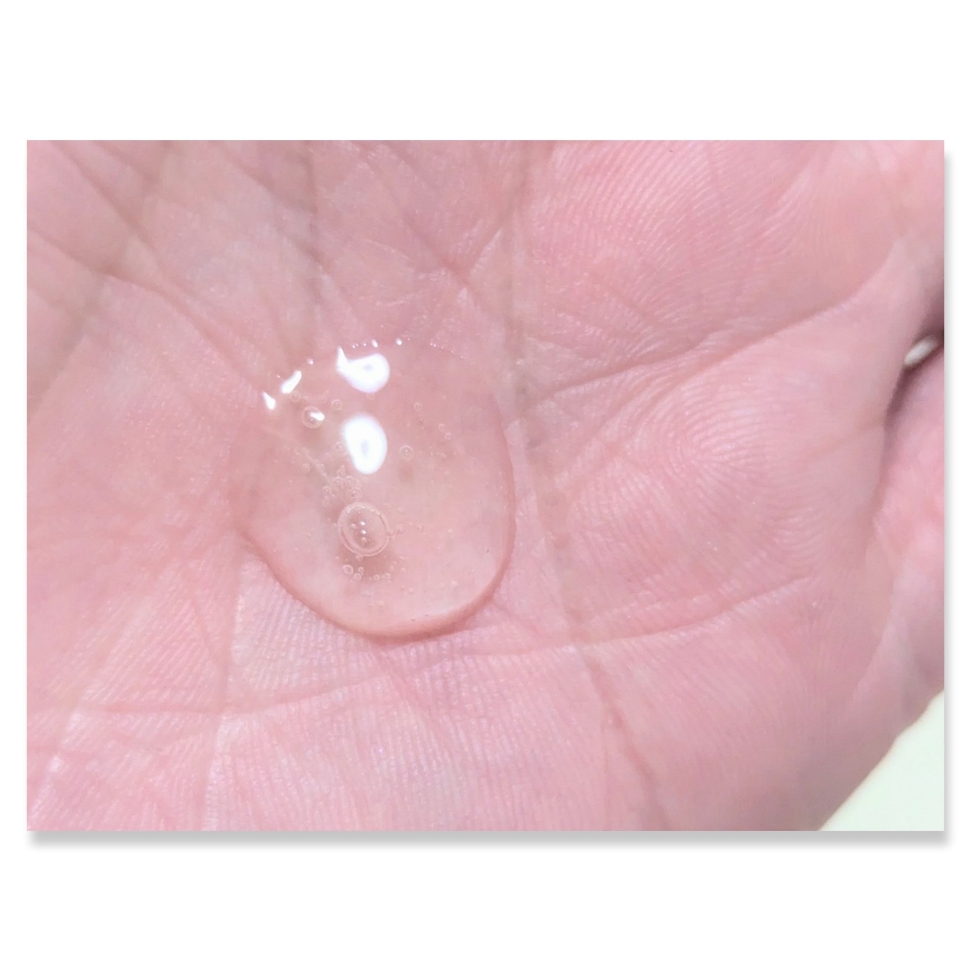 シカバイタル トナー/VT/化粧水を使ったクチコミ（2枚目）