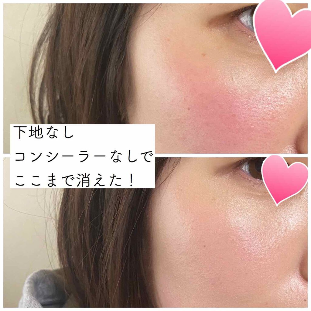 7レッドエナジーCファンデーション 22 ピンクベージュ /パルガントン/クリーム・エマルジョンファンデーションを使ったクチコミ（2枚目）