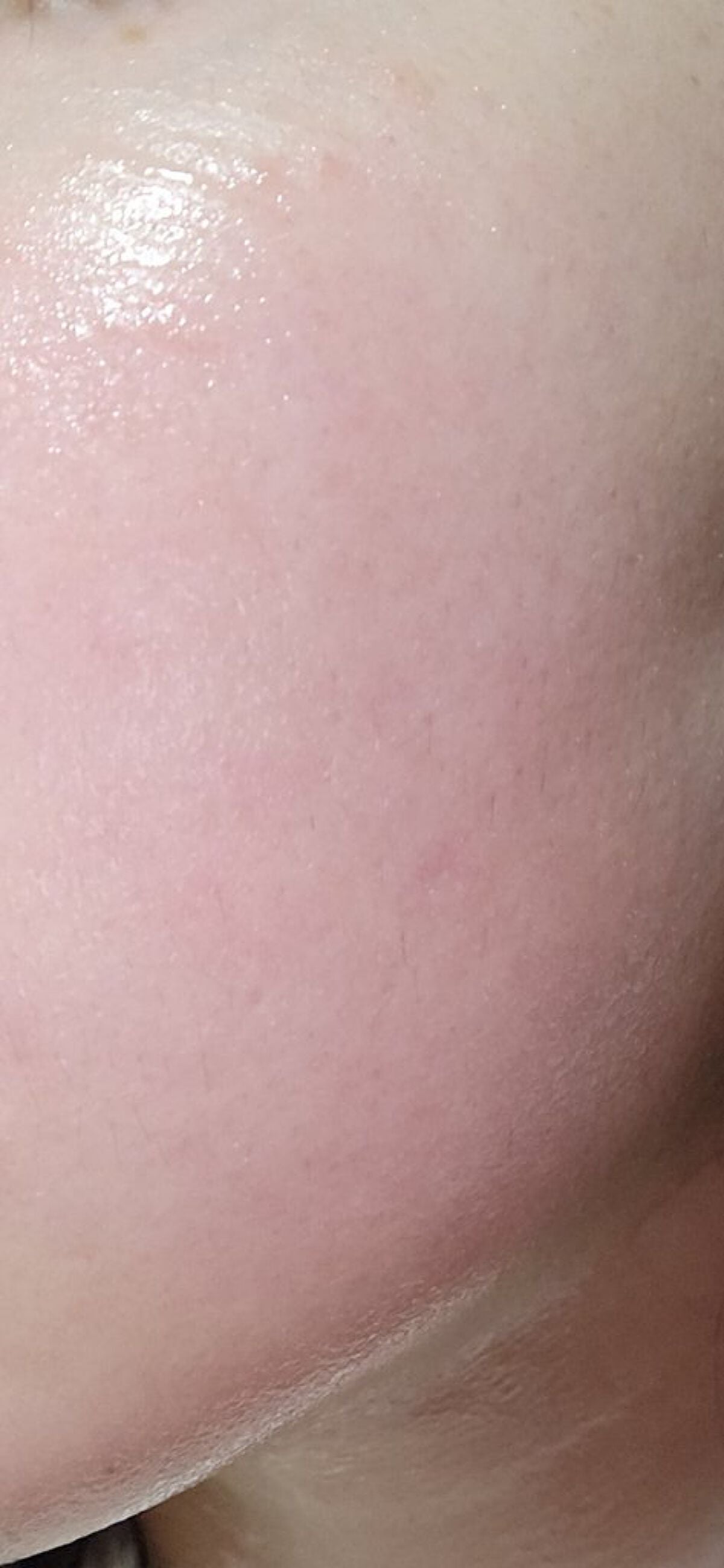 ダーマレーザースーパーVC100マスク/クオリティファースト/シートマスク・パックを使ったクチコミ(1枚目)