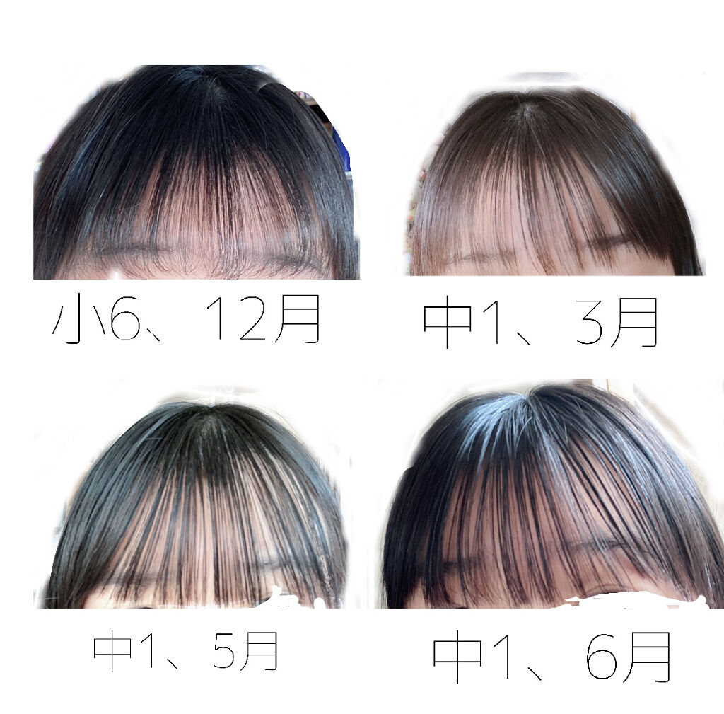 まとめ髪スティック スーパーホールド/マトメージュ/ヘアワックス・クリームを使ったクチコミ（3枚目）