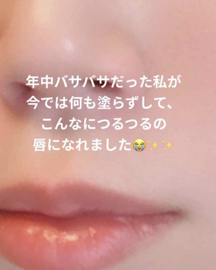 モアリップ N (医薬品)/資生堂薬品/その他を使ったクチコミ(2枚目)